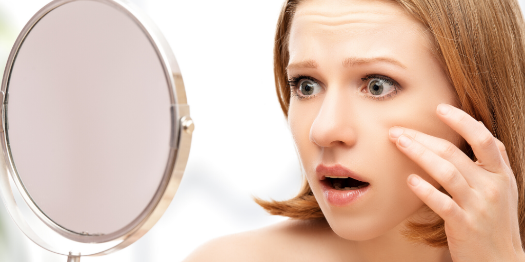 acne-worse.png