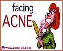 facing up to acne